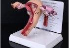 Definition of uterus, Anatomy, Function, Size, Position & Conditions