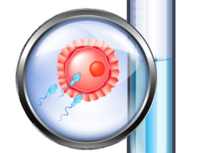 Are IVF Any Side Effects?